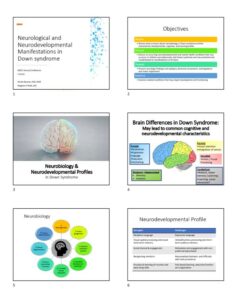  Neurological and NDD Conditions in DS, Baumer & O'Neill NDSC FINAL 2023 HANDOUT